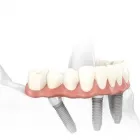 Business 1 image SPECIALIST ORAL SURGERY Oral Surgeon in North Fremantle WA