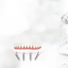 Business 2 image SPECIALIST ORAL SURGERY Oral Surgeon in North Fremantle WA