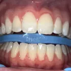 Business 1 image STUNNING SMILES Teeth Whitening Service in South Yarra VIC
