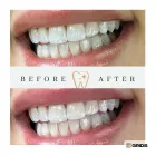 Business 2 image STUNNING SMILES Teeth Whitening Service in South Yarra VIC