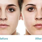 Business 2 image SYDNEY COSMETIC CLINIC Skin Procedures in Sydney NSW