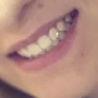 Business 4 image SYDNEY SMILES DENTAL Zoom Whitening in Chatswood NSW