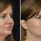 Business 1 image THE FACE INSTITUTE Skin Care in Chatswood NSW