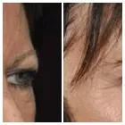 Business 7 image THE FACE INSTITUTE Skin Care in Chatswood NSW