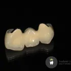 Business 2 image TRUDENT CERAMICS Dental Technicians in Melbourne East VIC