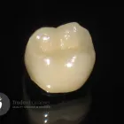 Business 1 image TRUDENT CERAMICS Dental Technicians in Melbourne East VIC