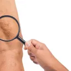 Business 3 image VEIN ARTERY SPECIALIST Vein Treatment in Carlton North VIC