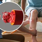 Business 4 image VEIN ARTERY SPECIALIST Vein Treatment in Carlton North VIC