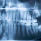 Business 6 image WISDOM TEETH PROFESSIONALS Health & Fitness - Centres & Services in Sydney NSW