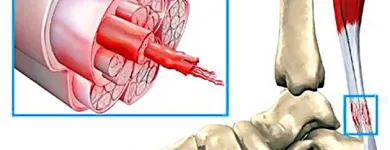 Business 3 image CITY PHYSIOTHERAPY & SPORTS INJURY CLINIC Remedial Massage Therapy in Adelaide SA