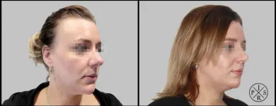 Business 2 image DR JOSEPH RIZK - PLASTIC & RECONSTRUCTIVE SURGEON Plastic & Reconstructive Surgery in Stanmore NSW