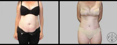 Business 4 image DR JOSEPH RIZK - PLASTIC & RECONSTRUCTIVE SURGEON Plastic & Reconstructive Surgery in Stanmore NSW