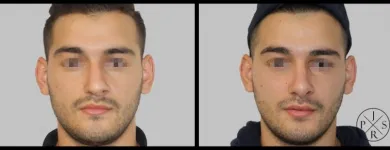 Business 5 image DR JOSEPH RIZK - PLASTIC & RECONSTRUCTIVE SURGEON Plastic & Reconstructive Surgery in Stanmore NSW