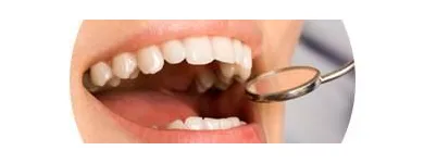 Business 3 image DR PAULO PINHO Wisdom Teeth Removal Cost in Sydney NSW