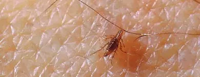 Business 2 image FLEA PEST CONTROL PERTH Pest Control in Perth WA