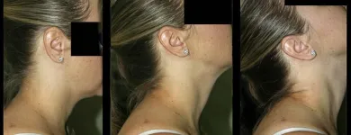 Business 3 image HELEN POTTER - IN TOUCH PHYSIOTHERAPY Physiotherapist in Subiaco WA