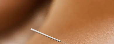 Business 10 image MOTION MYOTHERAPY NORTHCOTE REMEDIAL MASSAGE MELBOURNE Remedial Massage Therapy in Northcote VIC