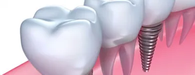 Business 2 image NO GAP DENTISTS Health & Fitness - Centres & Services in Sydney NSW