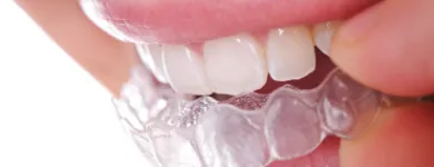 Business 4 image NO GAP DENTISTS Health & Fitness - Centres & Services in Sydney NSW