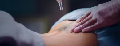 Business 1 image REVIVAL LASER CLINIC Tattoo Removal in Caloundra QLD