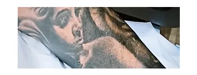 Business 3 image REVIVAL LASER CLINIC Tattoo Removal in Caloundra QLD