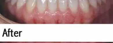 Business 2 image SANDSTONE POINT DENTAL Dentist in Sandstone Point QLD