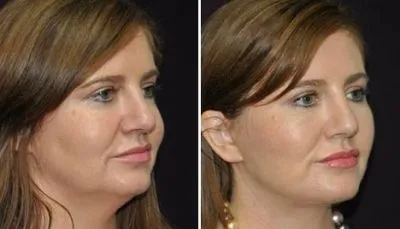 Business 1 image THE FACE INSTITUTE