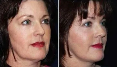 Business 2 image THE FACE INSTITUTE