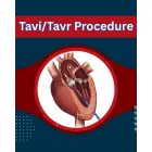 TRANSCATHETER AORTIC VALVE REPLACEMENT (TAVR) COST INDIA